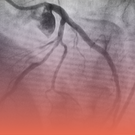 Angiogram in Kolkata - Kothari medical Centre 2