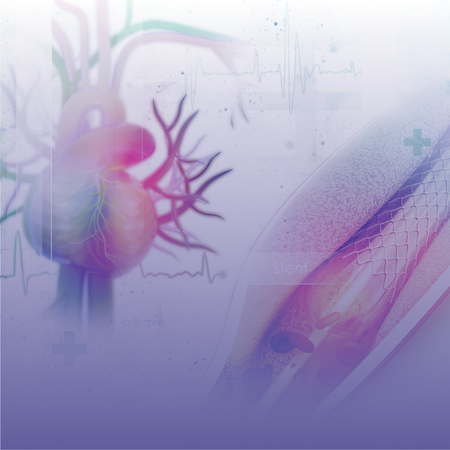 Angioplasty Hospital in Kolkata