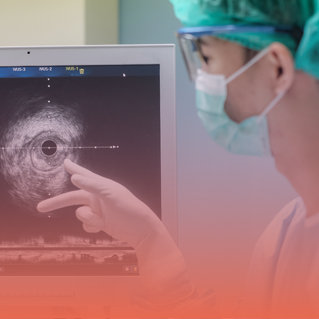 Cardiac Catheterization Kolkata - Kothari Medical Centre 2