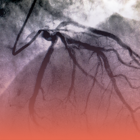 Cardiac Catheterization Kolkata - Kothari Medical Centre 5