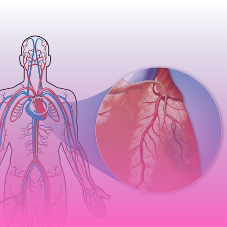 Cardiac Catheterization Kolkata – Kothari Medical Centre Cardiac Catheterization Kolkata - Kothari Medical Centre